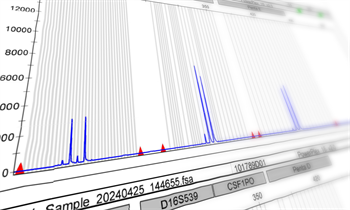 Example of an STR electropherogram